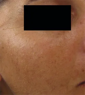 Antes e depois 4