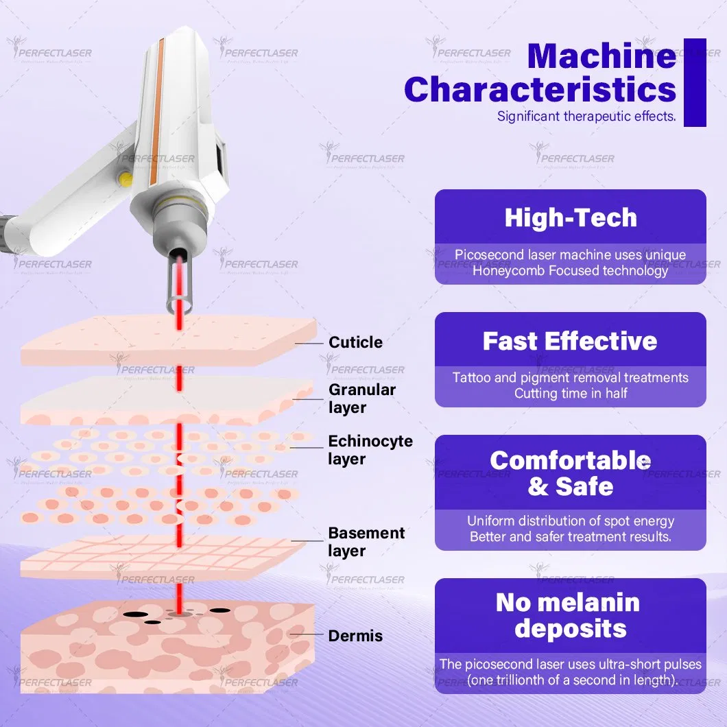 Equipamento de Beleza a Laser para Remoção de Pelos Vascular IPL de Qualidade 3 Comprimento de Onda ND YAG