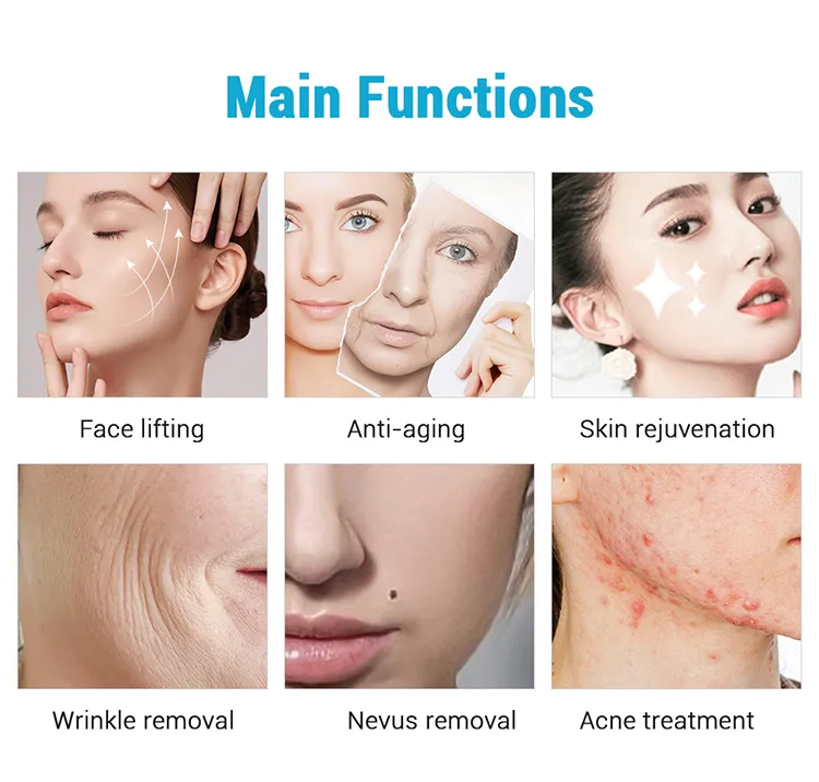 2 em 1 Dispositivo de Cuidados com a Pele de Rejuvenescimento Anti-Envelhecimento com Plasma Ozone e Lifting RF