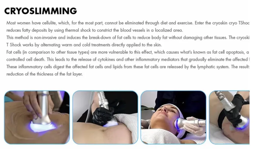 Crioterapia Facial e Corporal