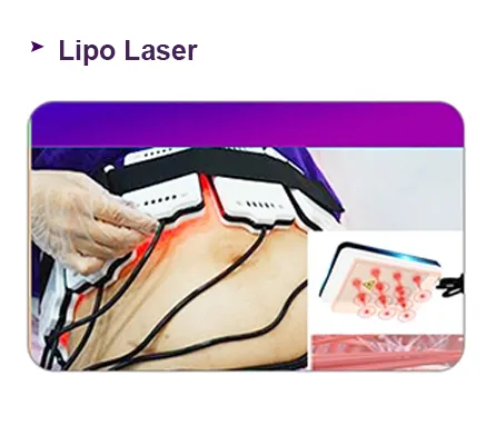 Laser Lipo