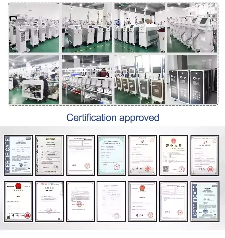 Embalagem e entrega do equipamento a laser ND YAG