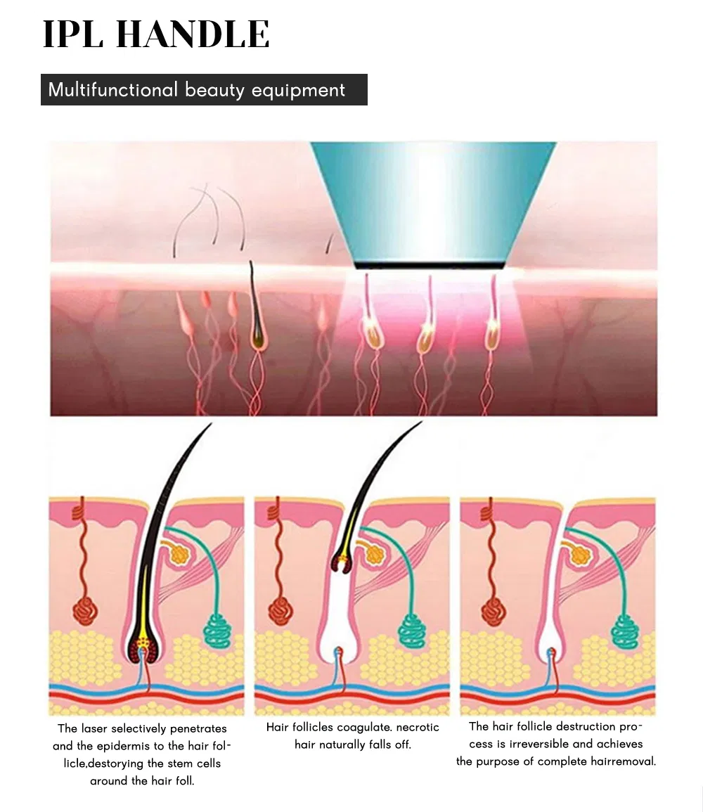 Aplicação ND Yag Laser 1
