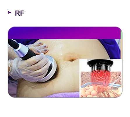 RF