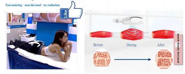 Equipamento de SPA para beleza Telsa EMS portátil para escultura corporal