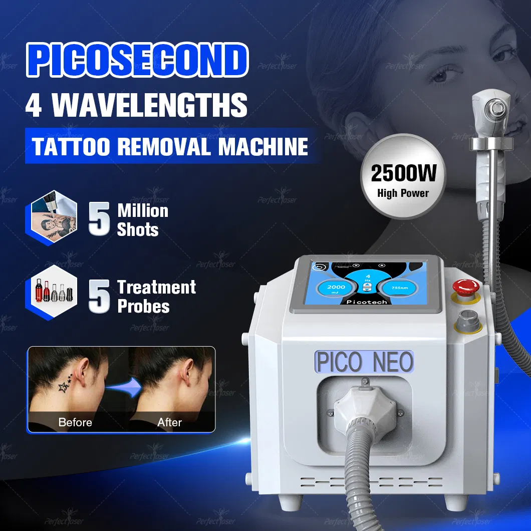 1320nm Laser de Picosegundo 532nm Q Switch Ativo ND YAG 1064nm Equipamento