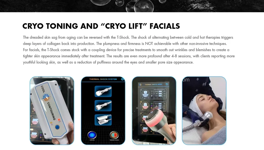Demonstração da Máquina Cryoskin 4.0