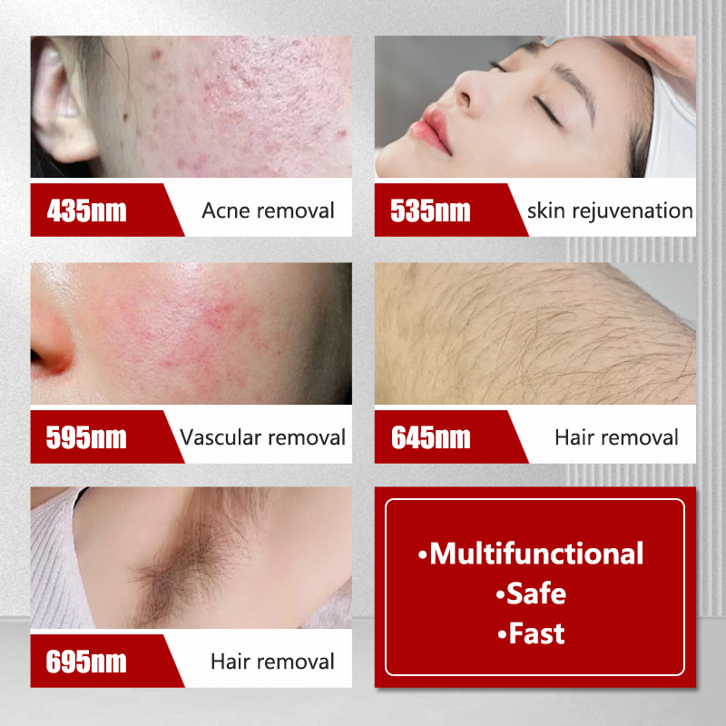 2026 Máquina de Remoção de Cabelo a Laser, Fotofacial IPL Bbl, Rejuvenescimento da Pele Nir