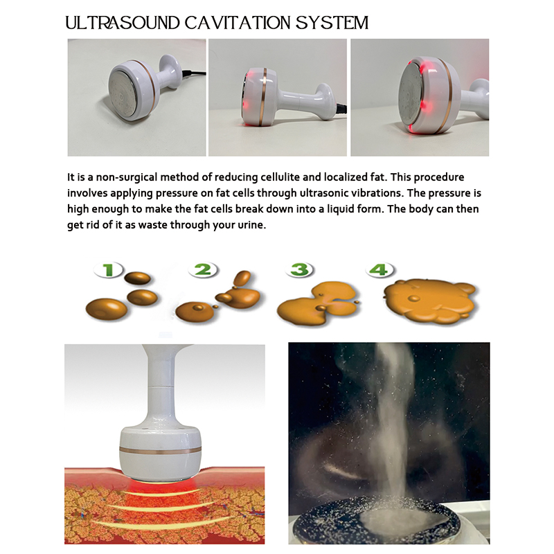 Máquina de Rosto com Cavitação por Rolos a Vácuo para Olhos RF Avashape Ava Shape Equipamento de Beleza