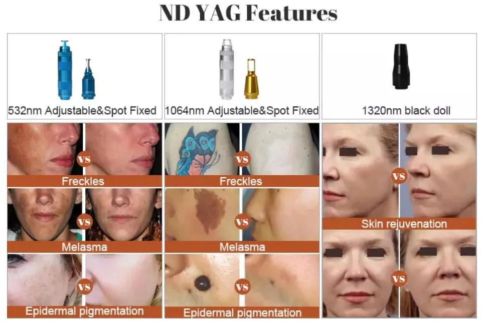 Resultados antes e depois da remoção de tatuagens a laser