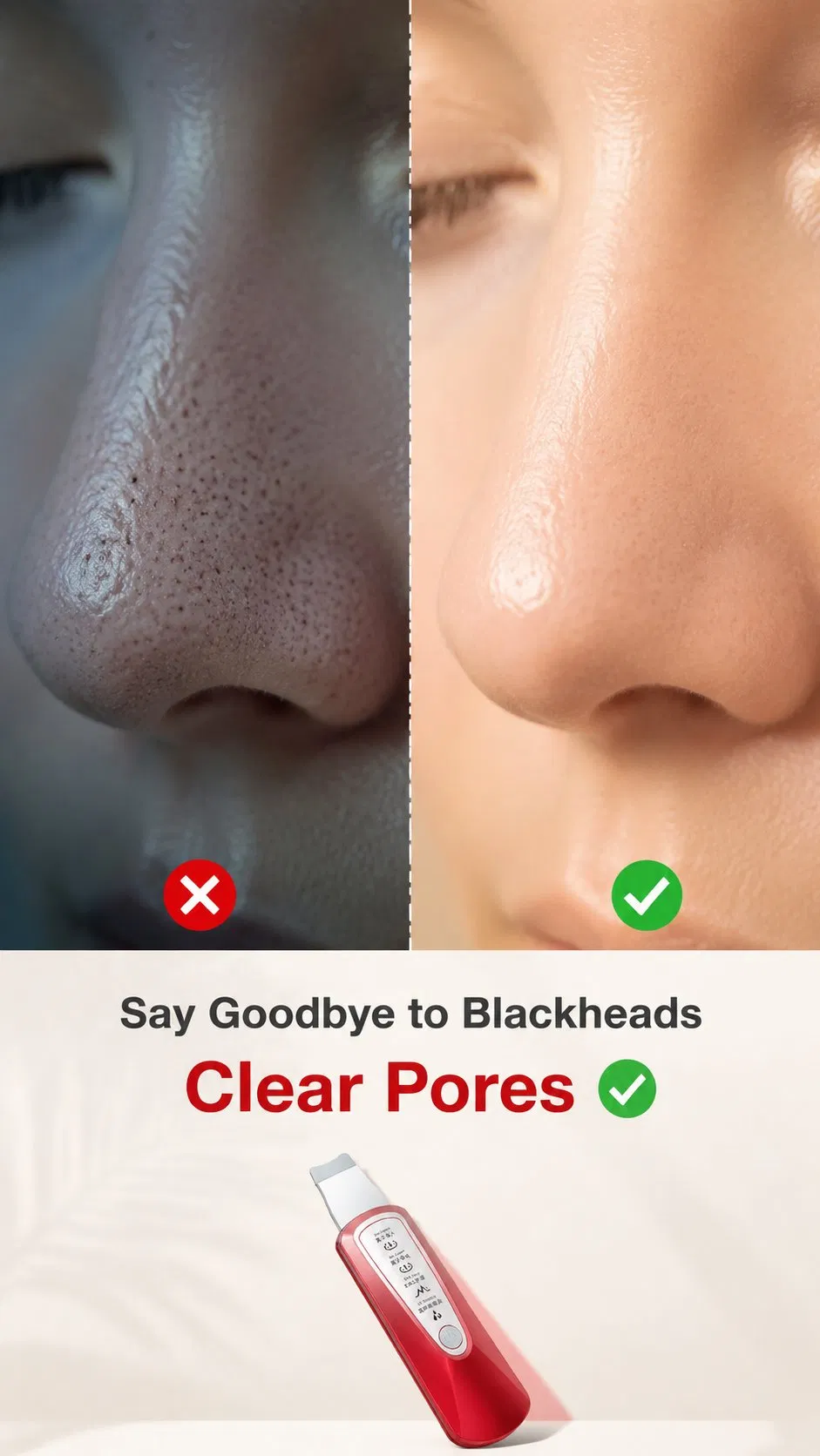 Limpador Facial Ultrassônico