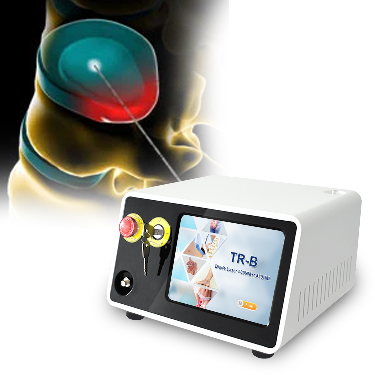 Tratamento a Laser Pldd com Diodo Endolaser 980 Nm 1470