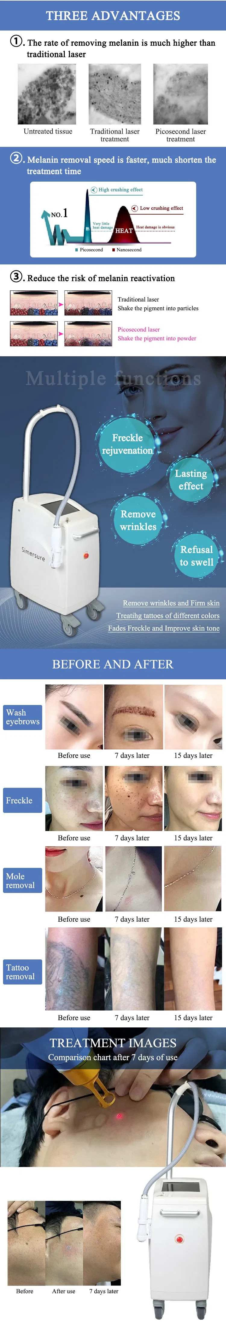 Manípulo e Acessórios Laser