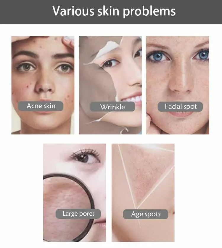 Máquina Multifuncional de Cuidados Faciais com Plasma