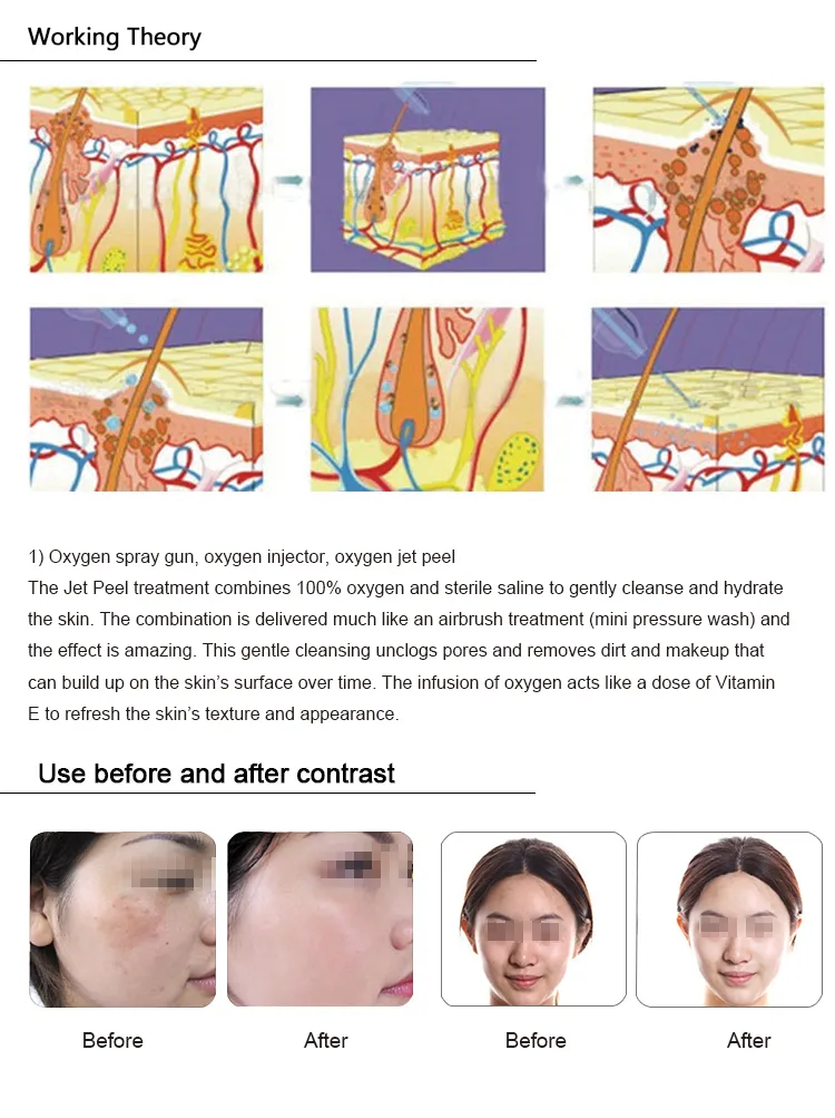 Máquina de Limpeza Profunda Facial de Boa Qualidade para Cuidados com a Pele, Equipamento de SPA para Lifting Facial Bio