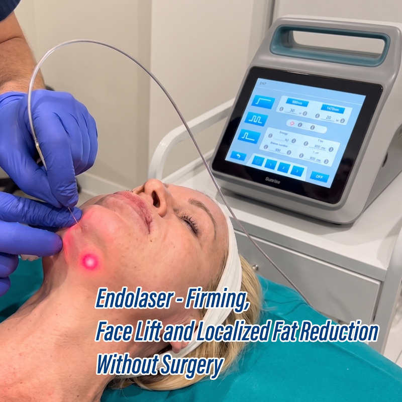 Laser Diodo Endolifting Laser Diodo 1470 Máquina De Endolifting Facial Laser Diodo Endolifting