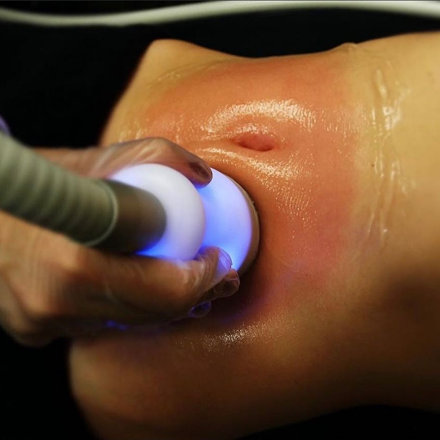 Nova Chegada Máquina de Crioterapia Cryo Tshock para Celulite, Lipólise e Cuidados com a Pele Cryotoning