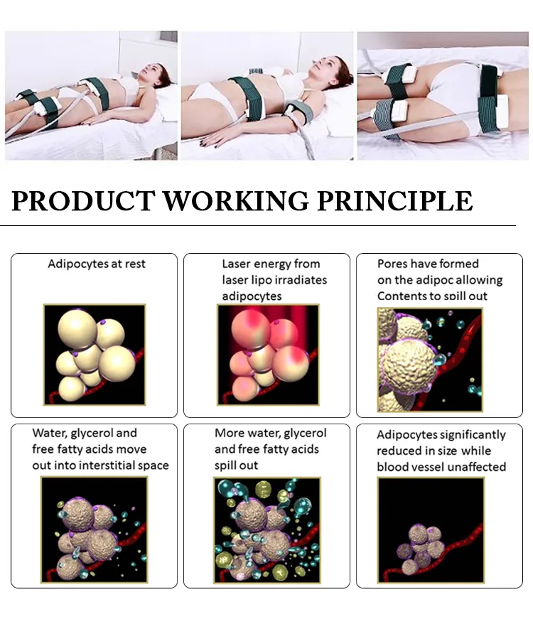 Máquina de emagrecimento corporal com laser lipolaser, criolipólise, laser lipo 336 diodo laser I-Lipo