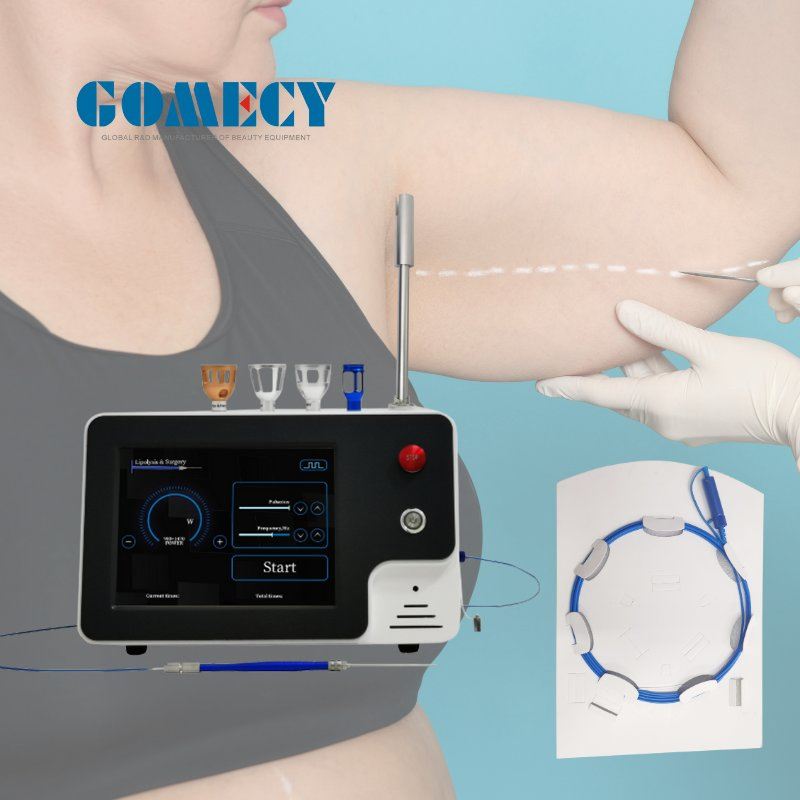 Laser Diodo 980 + 1470 Endolifting Endolifting Facial Laser Evlt 1470nm Máquina de Laser Médico