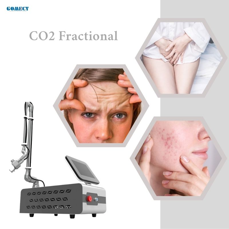 CO2 Dispositivo de Rejuvenescimento Facial com Laser para Eliminação de Rugas, Tratamento de Textura da Pele e Cicatrizes