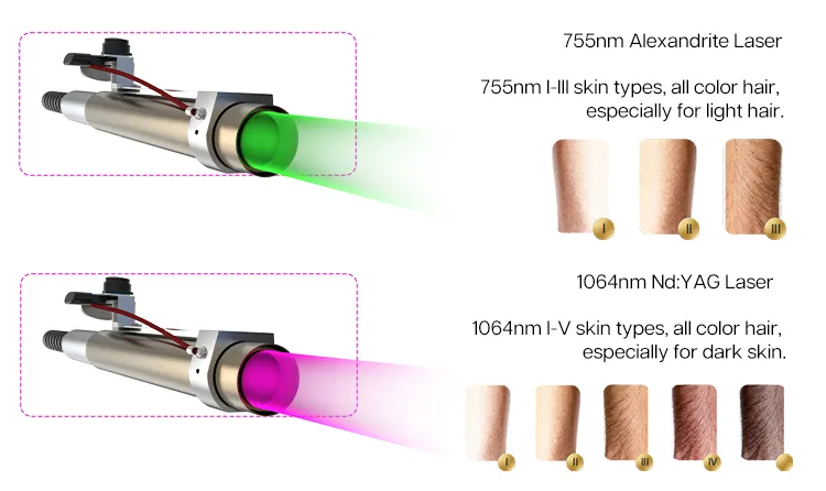 Processo de Remoção a Laser
