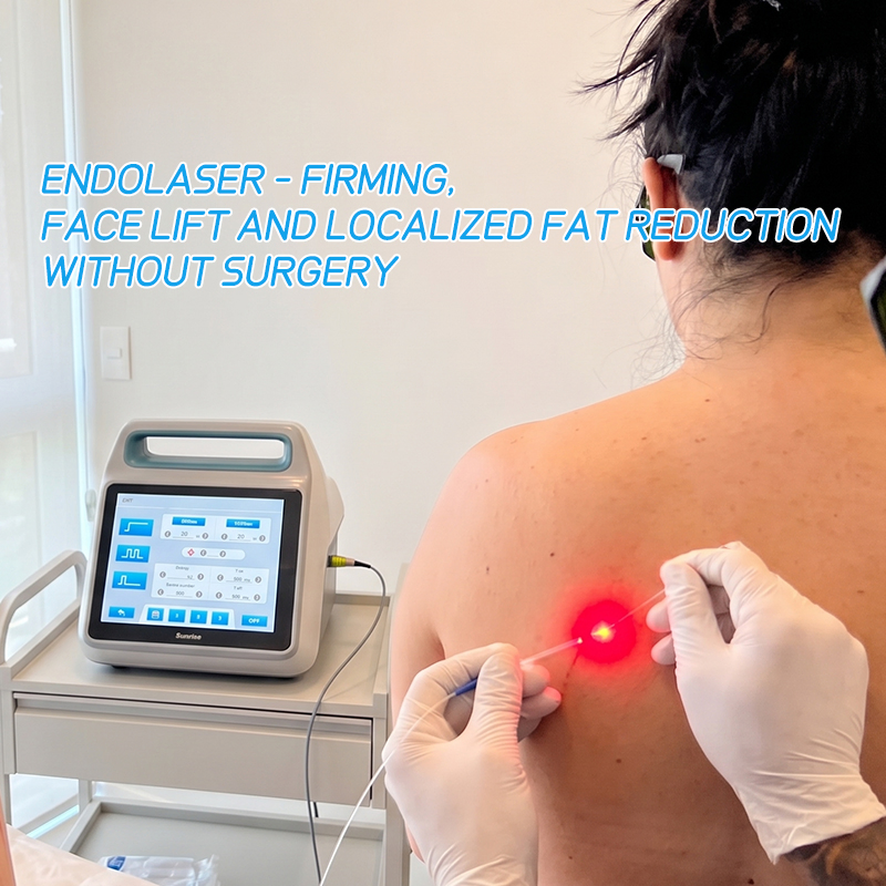 Laser Diodo Endolifting Laser Diodo 1470 Máquina De Endolifting Facial Laser Diodo Endolifting