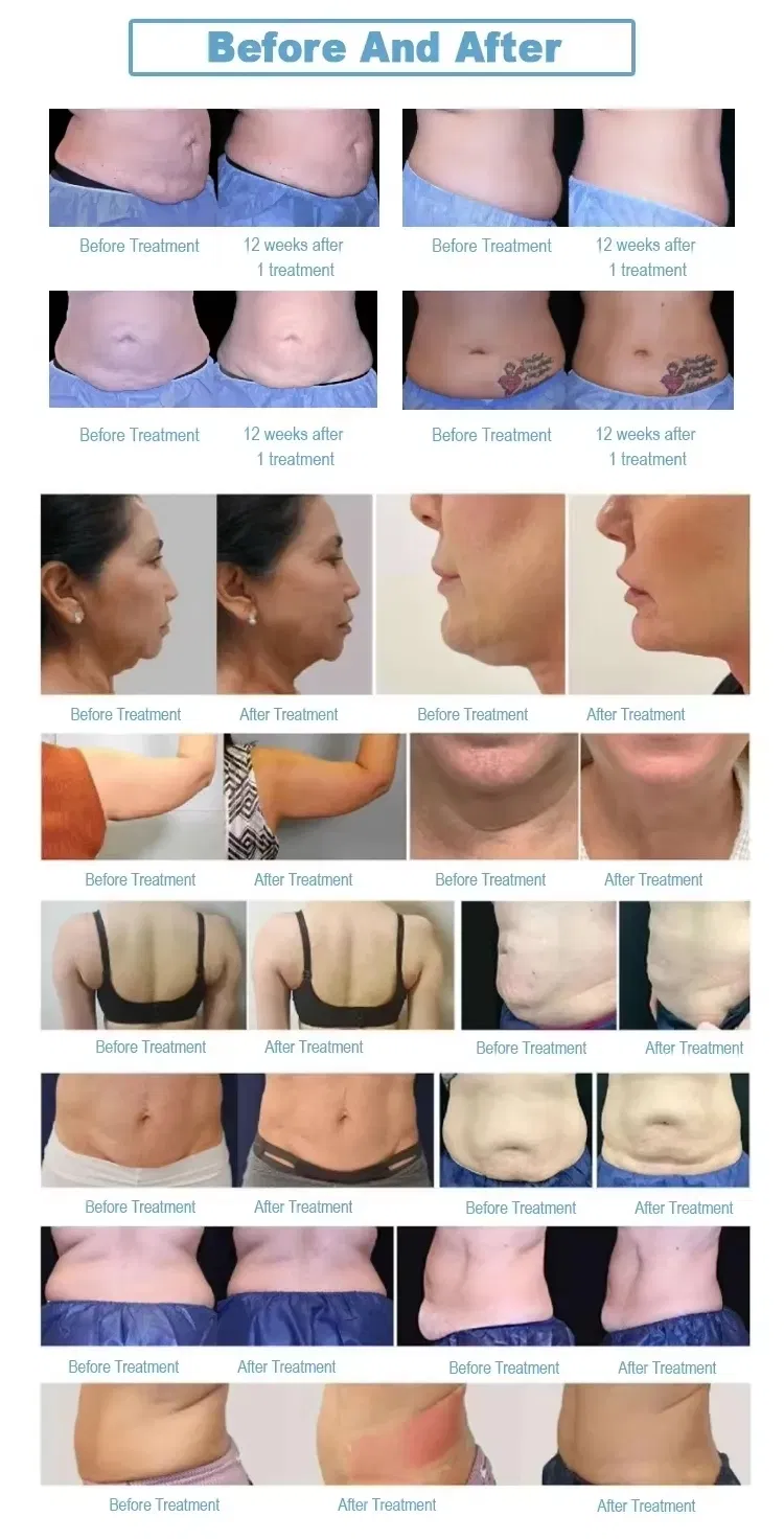Trusculpt Tecnologia