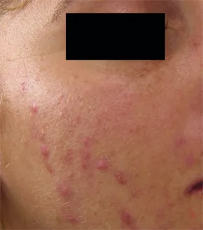 Antes e depois 3