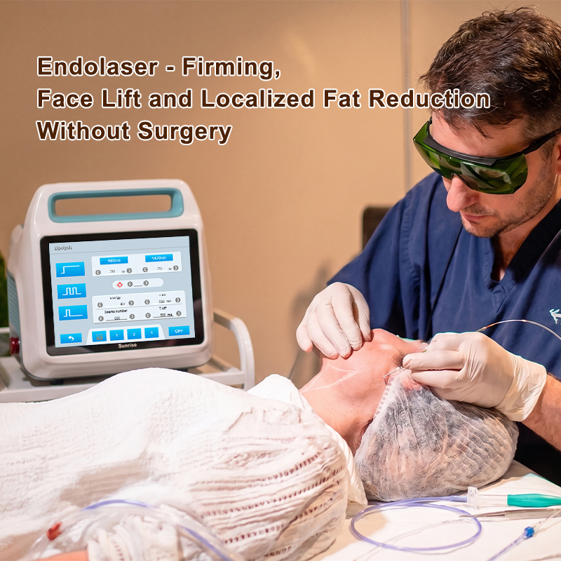 Laser Diodo Endolifting Laser Diodo 1470 Máquina De Endolifting Facial Laser Diodo Endolifting