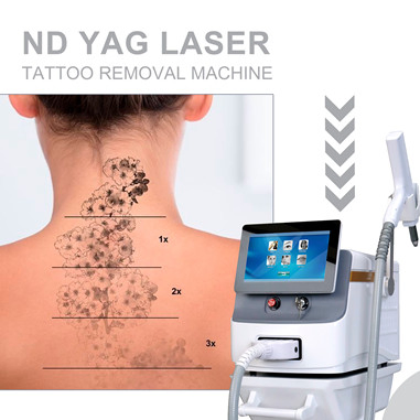 Máquina de Remoção de Tatuagem a Laser ND YAG 1064nm 532nm Ajustável 1-10Hz Remoção de Pigmentação Equipamento de Beleza