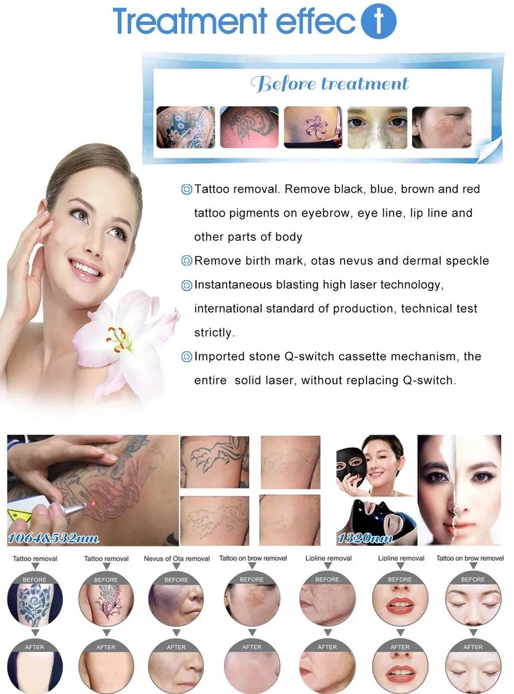 2023 Novo Equipamento de Remoção de Pigmento de Tatuagem e Rejuvenescimento da Pele com Laser ND YAG