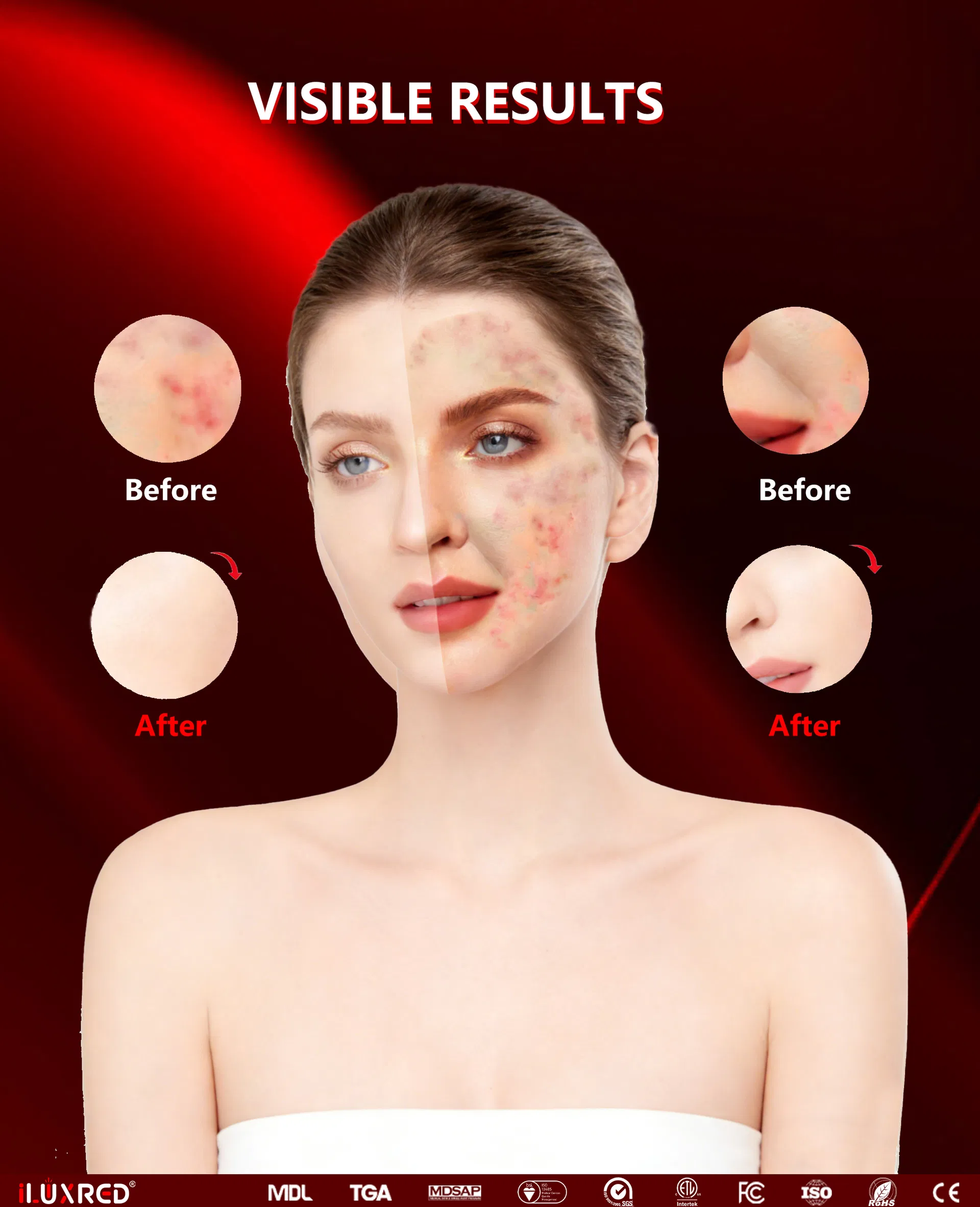 Medical Silicone LED Face Mask Info