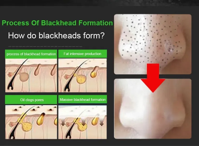 Activated Carbon Strong Effect Peeling off Face Mask Mud