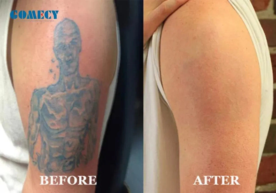 Before and After Results