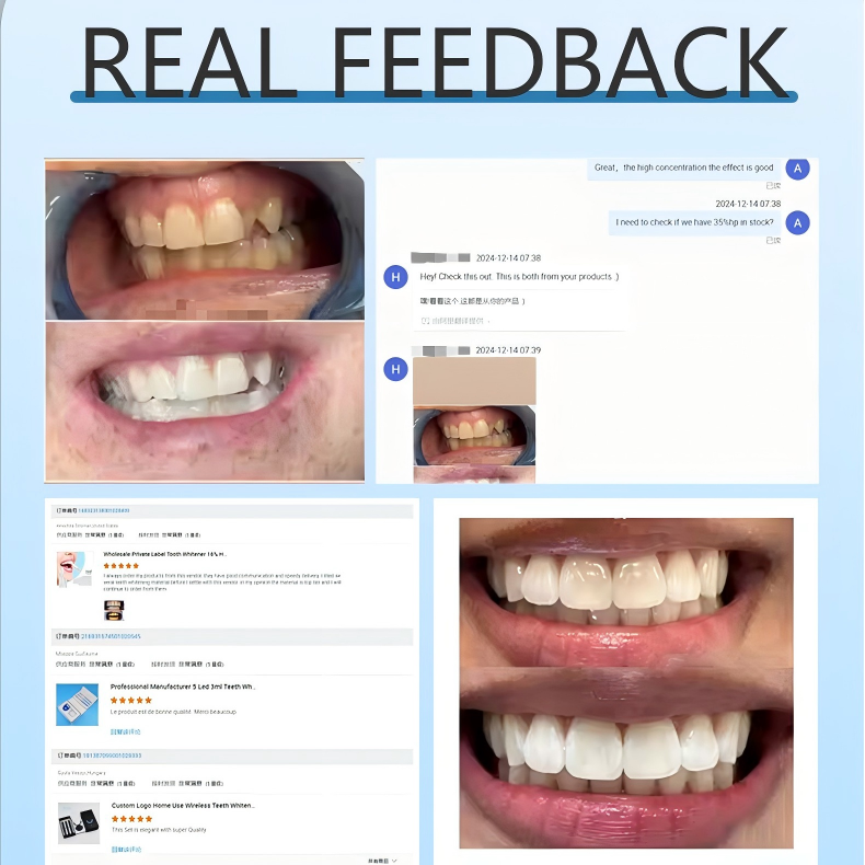 Luxury Private Logo Teeth Bleaching System Whitening Kit OEM ODM Teeth Whitening 5 LED Strips Kit with 7 Pairs of Whiten Strips