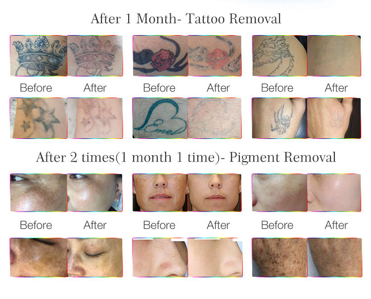 Before and After