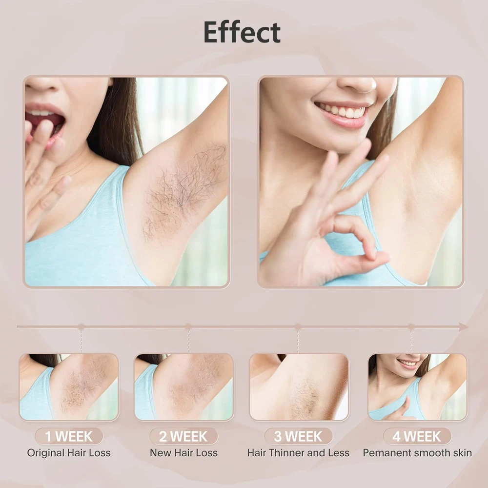 Household IPL Hair Removal Epilator Handset Machine With English Display Portable IPL Laser Machine Permanent Hair Remover