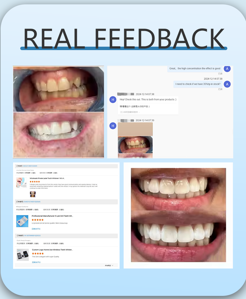 Purple Teeth Whitening Pen V34 Instant Color Correction No Sensitivity PAP Teeth Whitening Factory