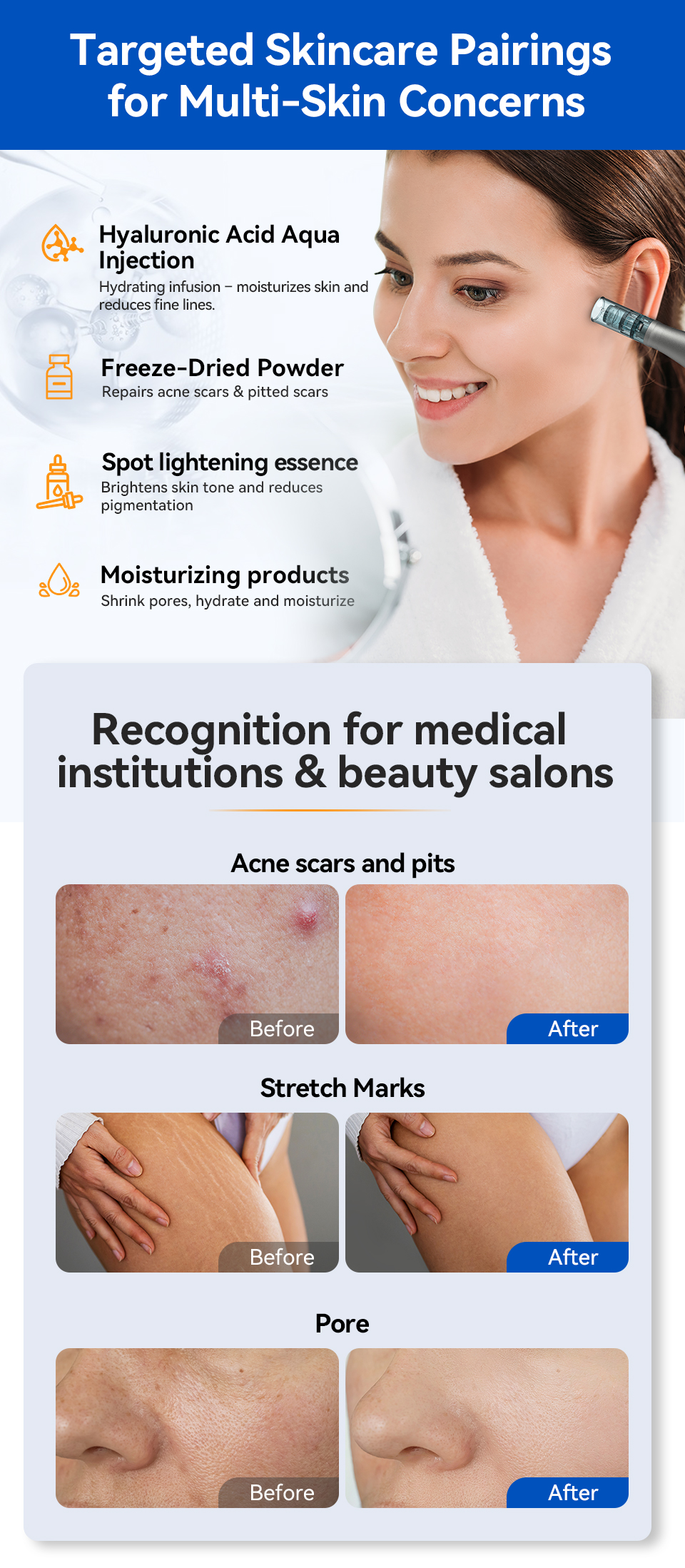 Product Advantages