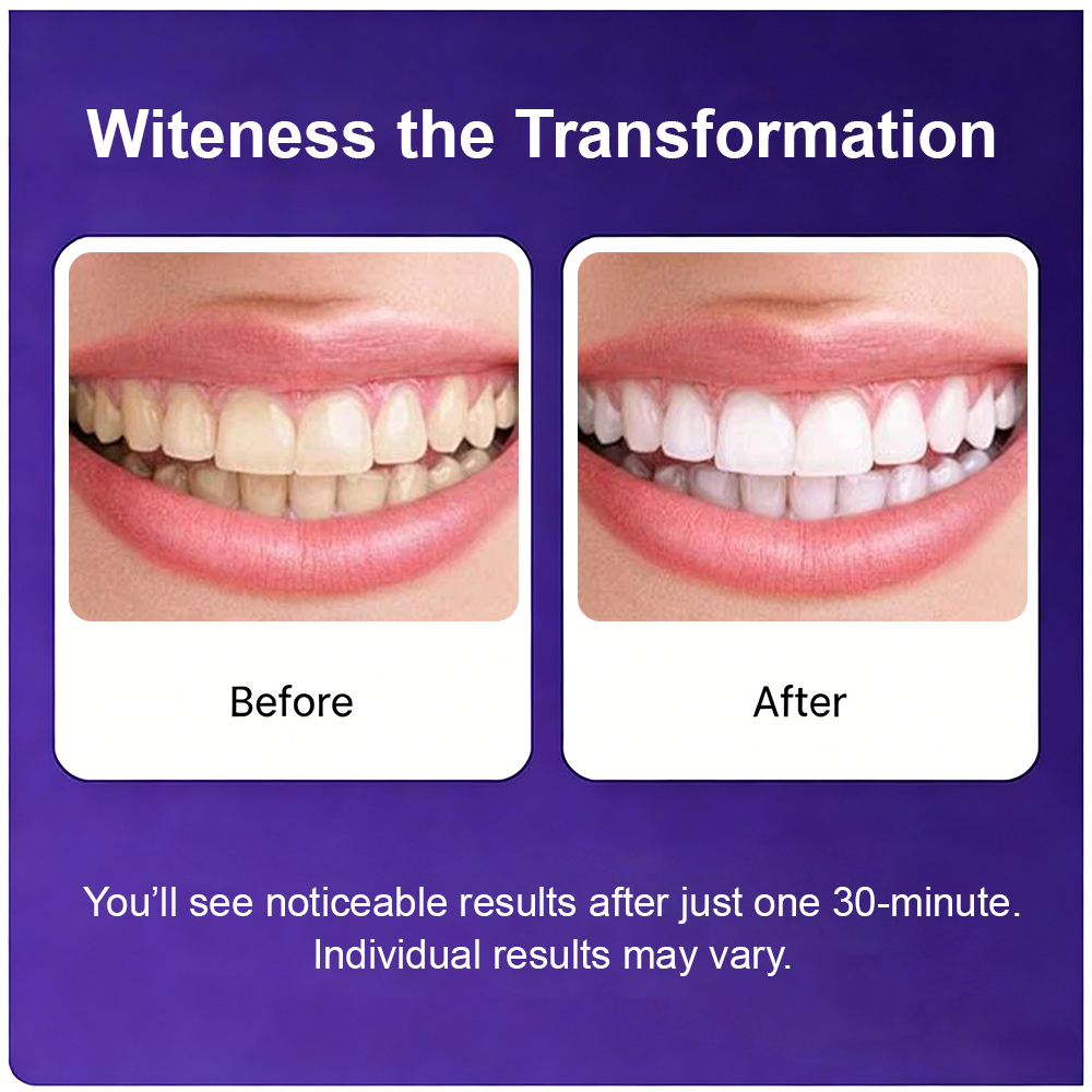 Whitening Strips 5