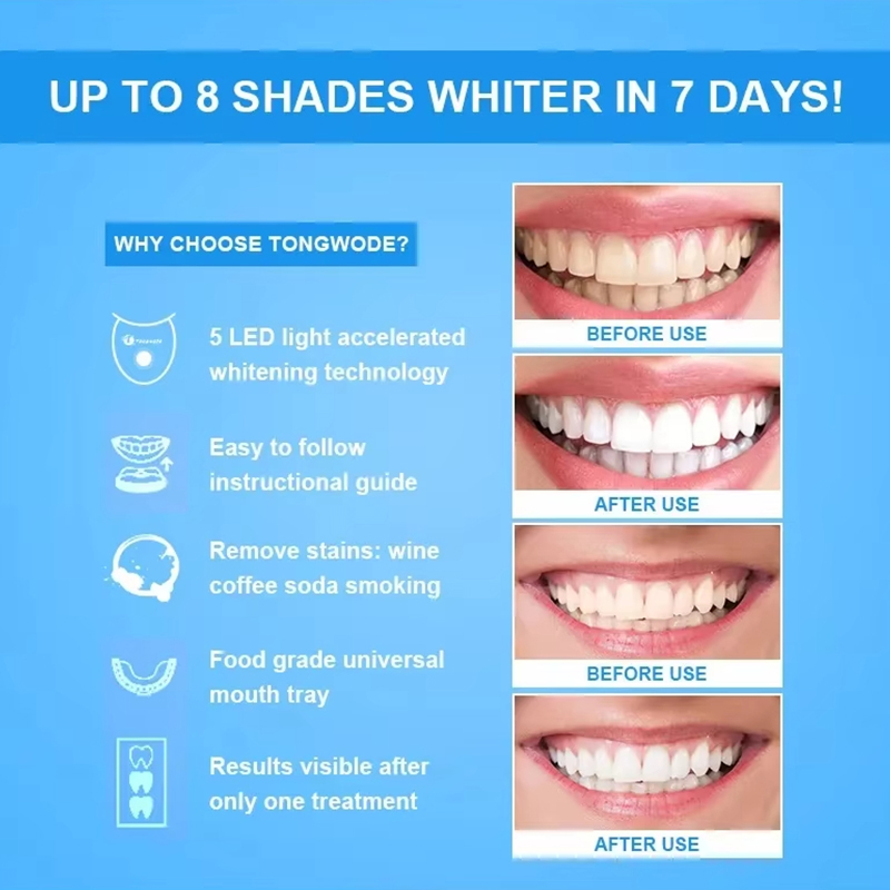 Teeth Whitening Kit 8