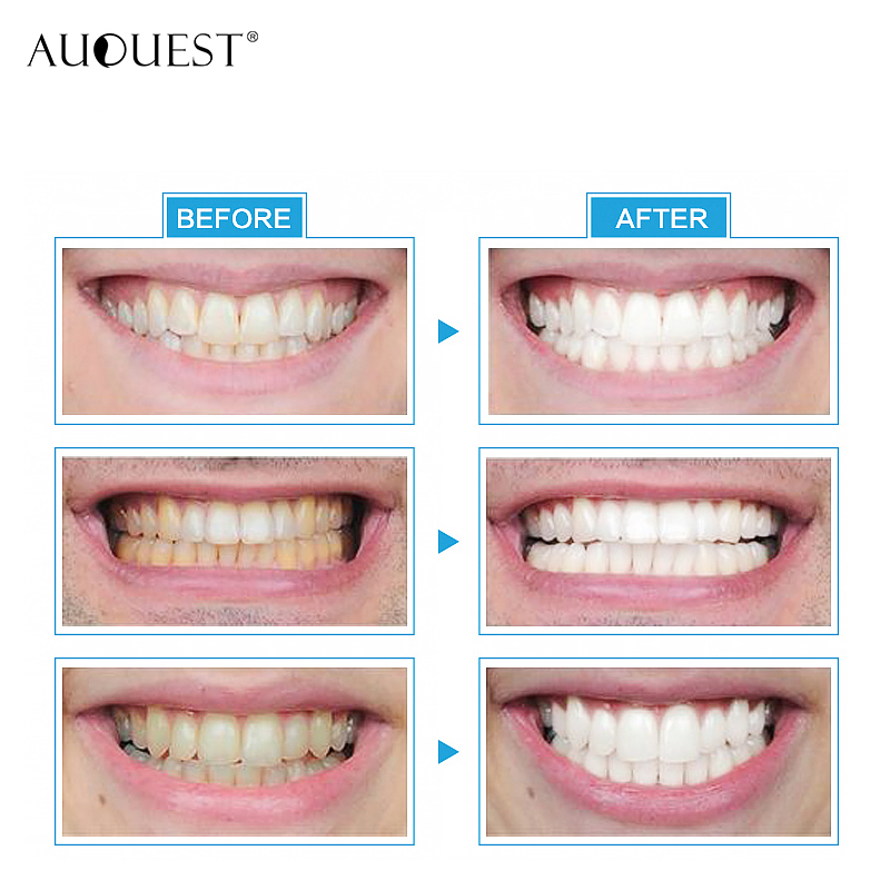 Teeth Whitening Kit with Led Light Cleansing Teeth Removal Stains Anti Yellow Charcoal Teeth Whitening Kit