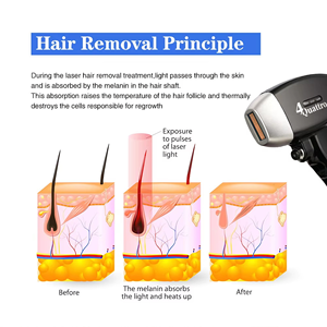 Portable 755nm 808nm 1064nm Wave Desktop Skin Rejuvenation Machine Hair Removal for Face Hands Feet Pico Second Tattoo Removal
