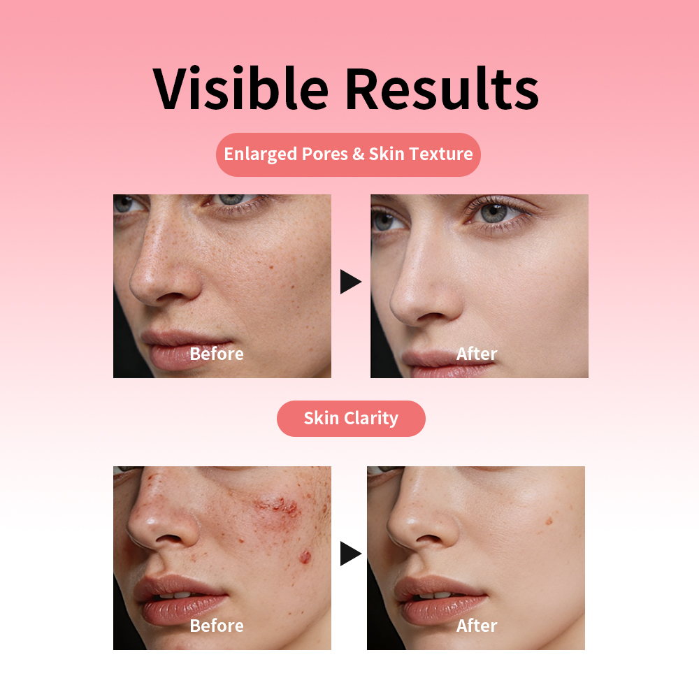 Wholesale Face Skin Care Moisturizing Boost Elasticity Korean Wrinkle Improve Hydrating Firming PDRN Liquid Microneedling Serum