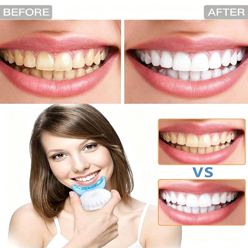 Professional 16 LED Light Wireless Teeth Whitening Kit Rechargeable PAP+ Non Peroxide Gel Home Use Dental Bleaching Set MANYA