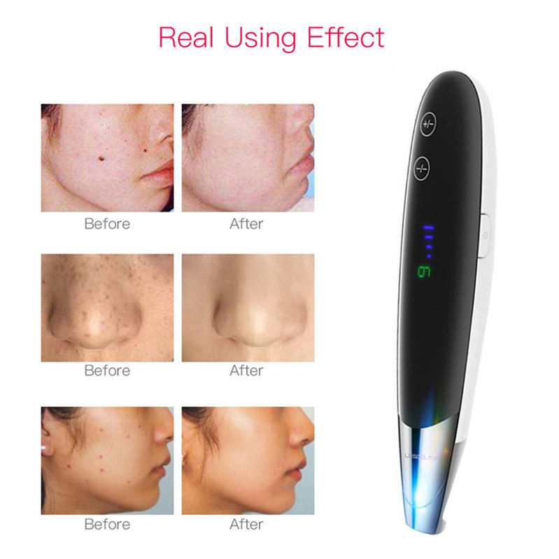 New Mini Picosecond Pen Home Beauty Device Makeup Cleaning New Pigment Removal Device for Hands Body Feet ABS AU