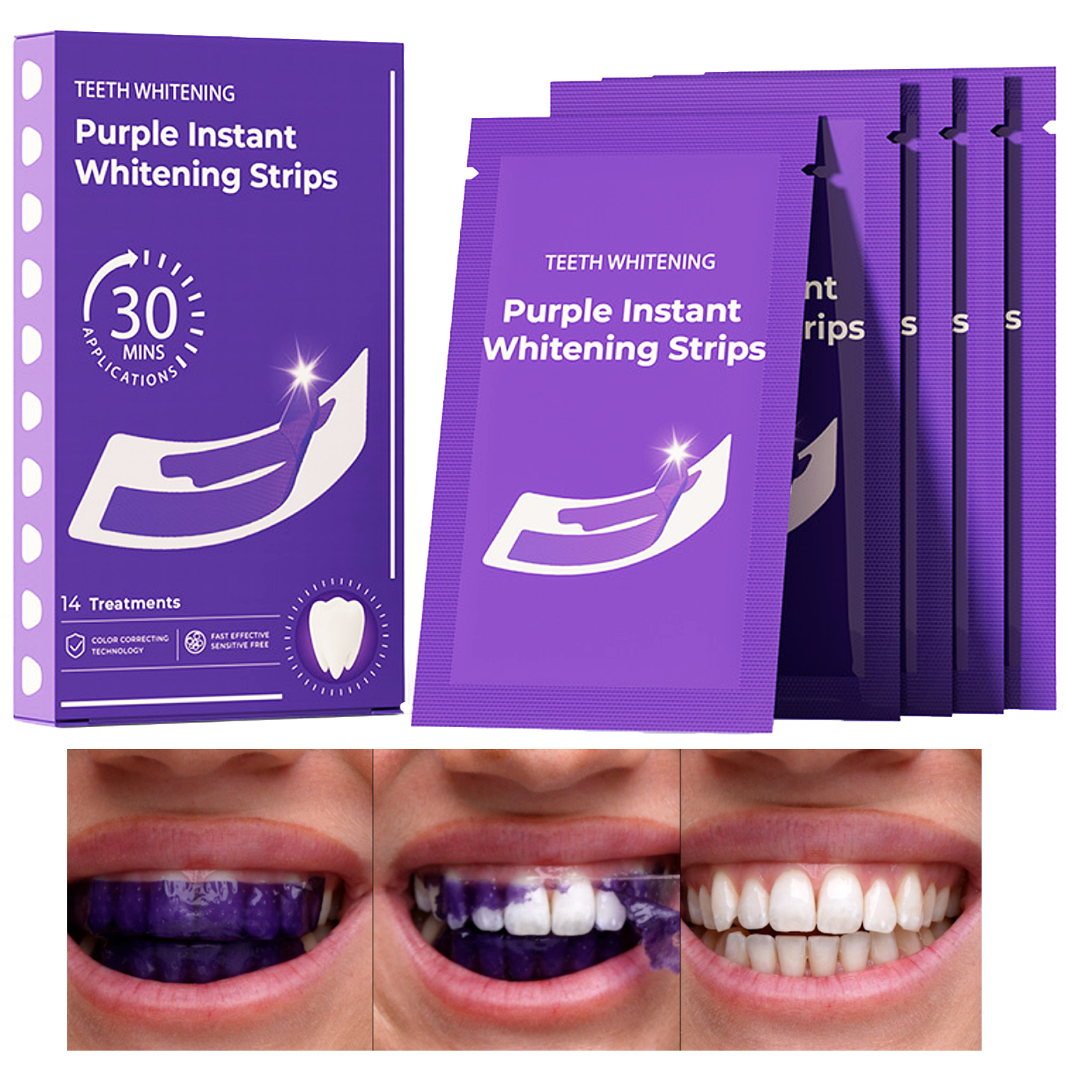 Purple Instant Teeth Whitening Strips, Purple Tooth Whitening, Tooth Stain Treatment, Whitening and Colour Correction