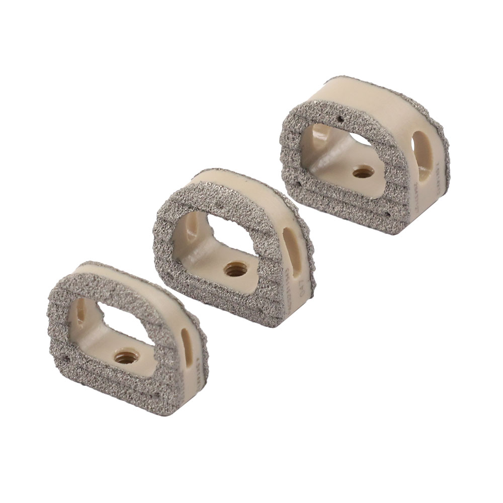 Geasure Orthopedic Implant Spine Cervical Fusion Cage PEEK Titanium Coating Class III 2-Year Warranty