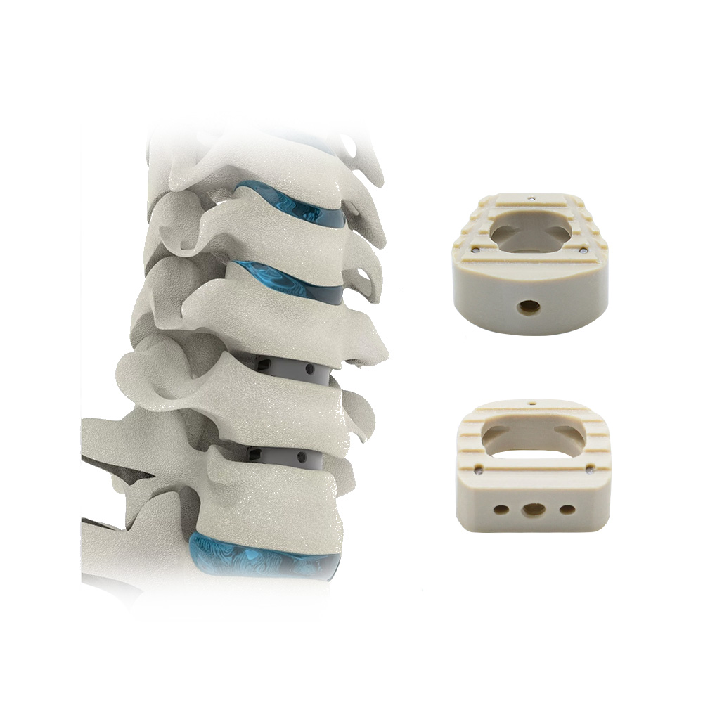 Geasure Medical-Grade PEEK Cervical Interbody Fusion Cage for Spinal Surgery