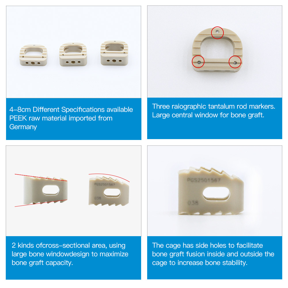 CE ISO Approved Geasure JZRH-II High Strength Radiolucent Peek Cervical Cage 4.5-7.5mm for ACDF Spinal Fusion Surgical